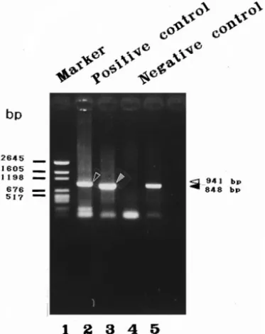 Fig. 4. PCR amplification of WSBV- and shrimp DNA-specific fragments using specific primer sets and DNA extracts from diseased and healthy P