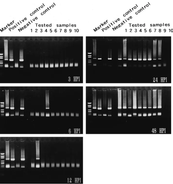 Fig. 5. Detection of WSBV by PCR with WSBV-specific primer sets 146 F2 and 146 R2 using DNA extracts from juvenile P