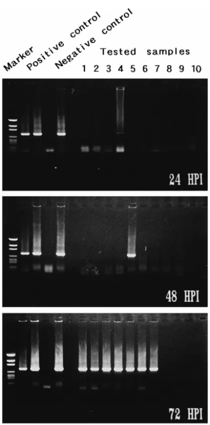 Fig. 6. Detection of WSBV by PCR with WSBV-specific primer sets 146 F2 and 146 R2 using DNA extracts from postlarval P