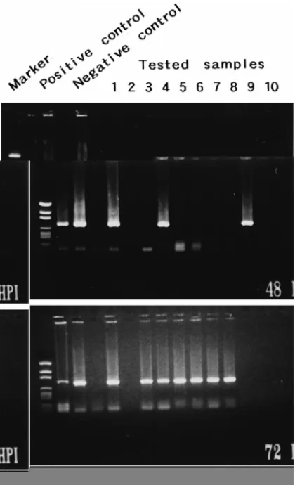 Fig. 7. Detection of WSBV by PCR with WSBV-specific primer sets 146 F2 and 146 R2 using DNA extracts from postlarval P