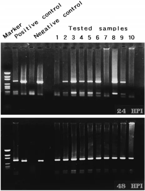 Fig. 8. Detection of WSBV by PCR with WSBV-specific primer sets 146 F2 and 146 R2 using DNA extracts from young adult P
