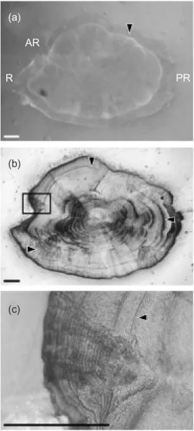 Fig. 2. Tetracycline (TC) mark and daily growth increments (DGIs) in a sagittal-sectioned juvenile grey mullet otolith  pho-tographed by fluorescent light (a) and reflected light  micro-scope (b, c)