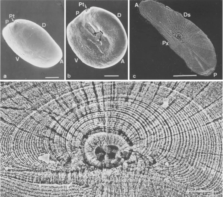 Fig. 4.  Anguilla japonica. Scanning  electron  micrographs  illustrat-  ing external feature and internal microstructure  of sagittal otolith of  an elver collected in the Shuang-Chi  River estuary on December  14,  1985