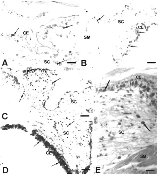 Fig.  1  Detection  by  in  sltu  hy-  bridization  of  white  spot  syn-  drome  associated  non-occluded  baculov~rus  (WSBV) in the stom-  ach  of  experimentally  infected  shrimp  sampled  at  different  times: (A) 16 h post-infection (pi),  (B1  22 h