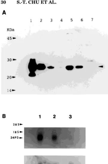 Figure 3 shows the results from testis and epididymis using light microscopy to describe the  immunolocaliza-tion of 24p3 protein