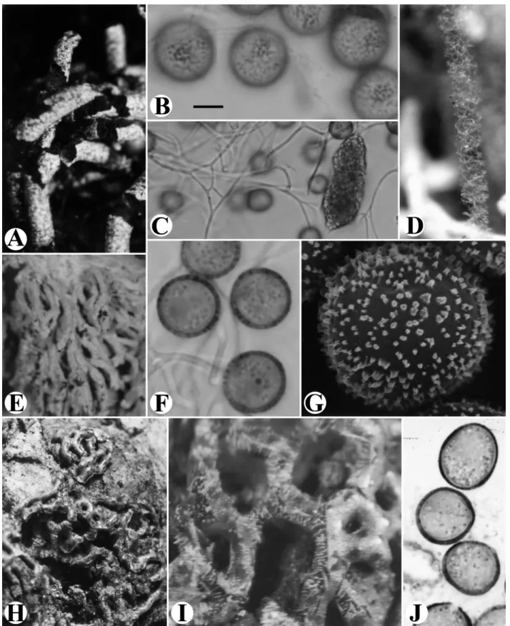 Fig. 2. A-G. Fuligo aurea. A &amp; E: Fruiting bodies. B: Surface view of spores. C: Capillitial threads and lime node