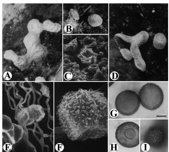 Fig. 3. Didymium leptotrichum. A-B &amp; D: Fruiting bodies. C: Lime crystals on the outer surface of peridium