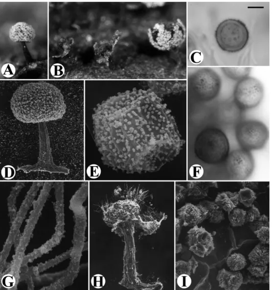 Fig. 4. Didymium minus. A: Fruiting body. B: Dehiscent sporangia. C: Spore, marginal view