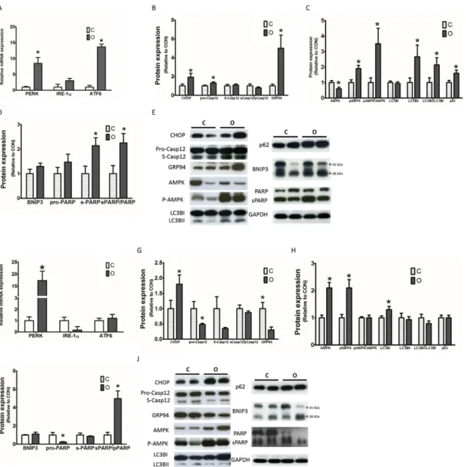 Fig. 3. mRNA expression of signaling regulators for ER stress in the LV of MetS (A) and MHO pigs (F)