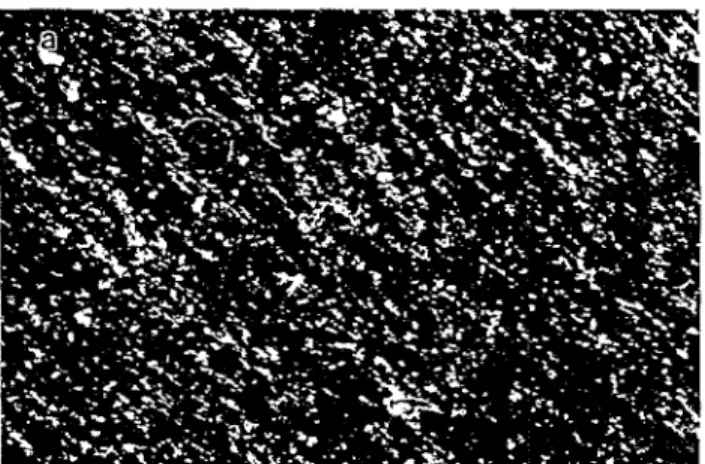 Fig. 3.  Scanning electron micrographs of the surface morphology of  non-ion-nitrided equiatomic TiNi alloys after immersion in: (a)  1 M  HC1 solution for 14 days; (b) in 1 M H2SO 4 solution for 5 days