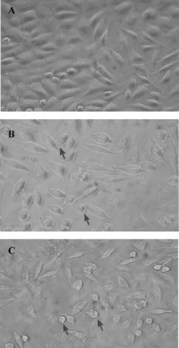 Fig. 1 Comparative morphology of L929 cells under 24p3  protein incubation. L929 cells were incubated in medium in  the presence or absence of 24p3 protein for 72 h