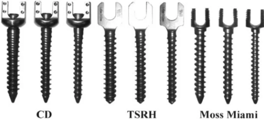 Fig.  1.  Three different pedicle screws tested in this study. Each had three type-I,  11, and IIILcorresponding  to different outer diameters