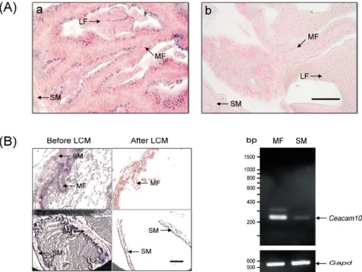 FIG. 4. Ceacam10 expression in the luminal epithelium of the seminal vesicle. A) Immunolocalization of CEACAM10 to the luminal epithelium of the seminal vesicle