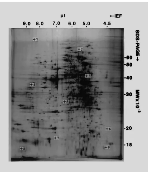 Fig. 8. 2D gel analysis of the proteins from Fusarium sporotrichioides, a fungus strain of plant pathogens