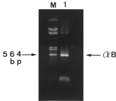 FIG. 1. Identification and size determination of PCR-amplified on reversed-phase HPLC according to the previous report (15).