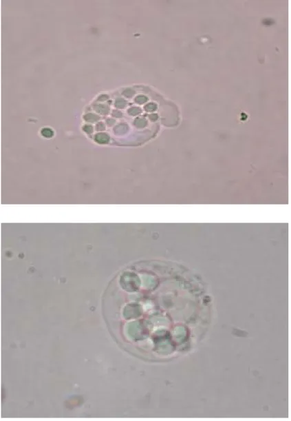 Fig. 4. Phagocytosis assay of differentiated U937 cells observed under microscope  (Magnification 1000 X)