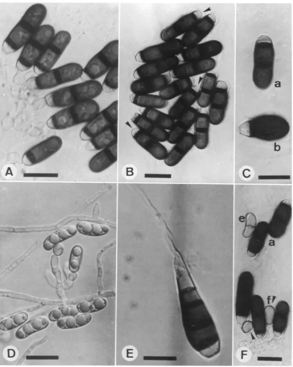 FIG.  2.  A-F.  Conidiogenous  cells  and  pleomorphic  conidia  of  Triadelphia diversa