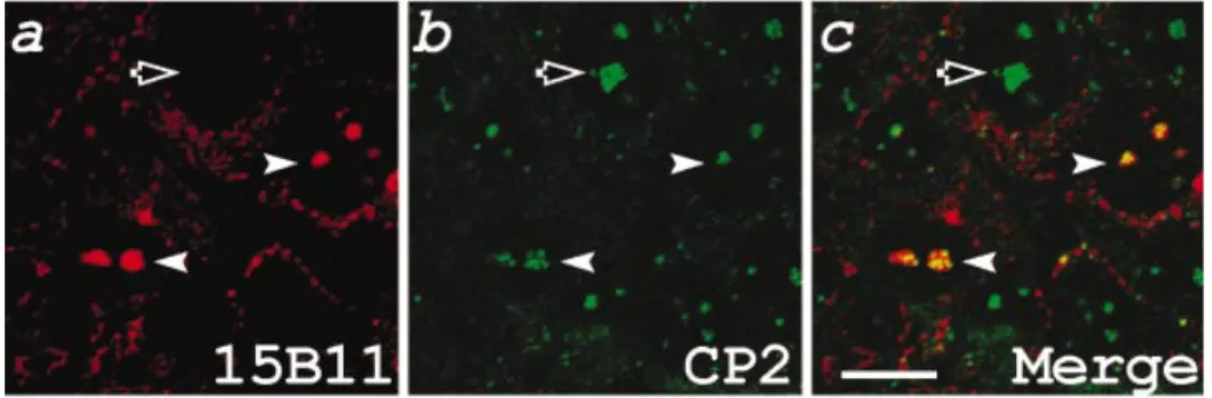 Fig. 4. Nucleolus localization of the core protein in DEN-infected cells. HuH-7 cells were infected with DEN (m.o.i.l 5) for 18 h.