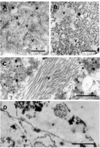 Fig. 3. Virus-like particles in N. tabacum protoplasts infected by specific LIYV mutants