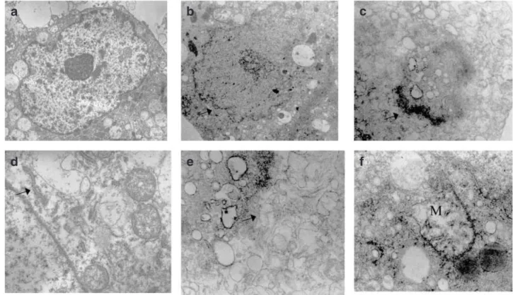 Fig. 2 After a 48 h incubation with and without cefotaxime (CFT; 1 mg/mL; the same picture was noted after treatment with ceph- ceph-alothin (CPL; 0.5 mg/mL)), the human peritoneal mesothelial cells (HPMC) were examined by electron microscopy