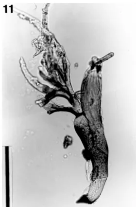 Figure 11.  Laboulbenia separata removed from left elytral mar- mar-gin of Pericalus formosanus