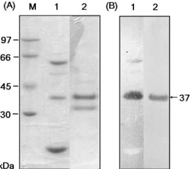 Figure 2 shows the result of Southern blot analysis using the 300-bp DNA probe. EcoRI-digested genomic DNA of B