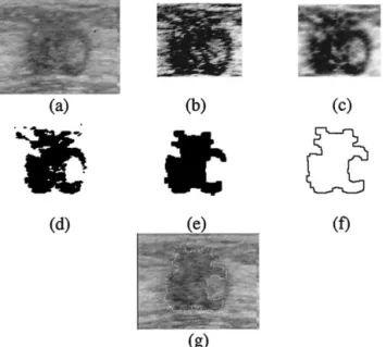 Fig. 15. The resulting images of tumor 8. (a) The original image. (b) The equalized image of (a)