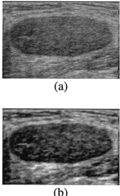Fig. 3. The result of the stick filter. (a) The original image. (b) The stick image of (a).