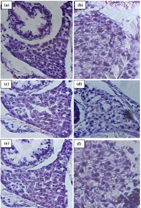 Figure 1. In situ Detection of DNA fragmentation by TUNEL assay. The DNA fragmentation (brown nucleus) indicates TUNEL positive cells