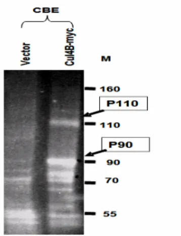 Fig 9. Co-immunoprecipitation. Sypro Ruby stain gel showing the result of 