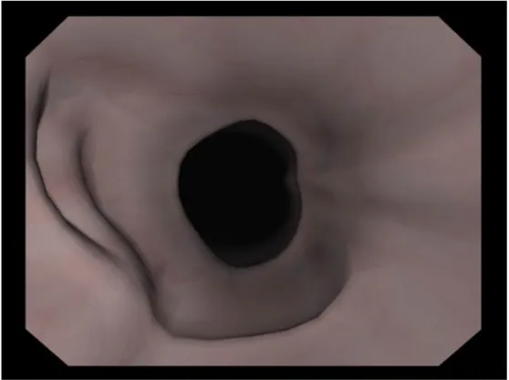 圖 3-1：3D 立體虛擬大腸鏡檢查系統。