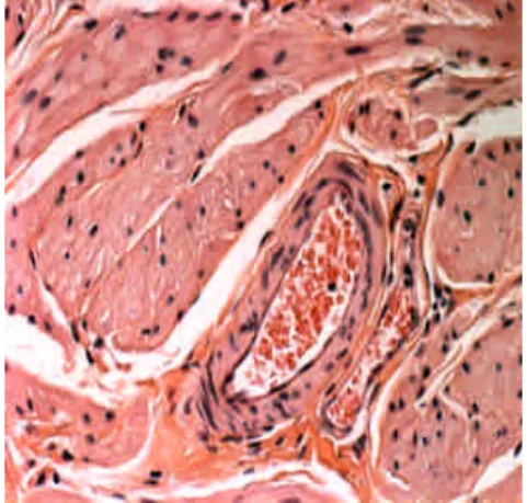 Fig 4 代謝糖尿病鼠合併膀胱收縮不良之膀胱病理切片(HE stain)