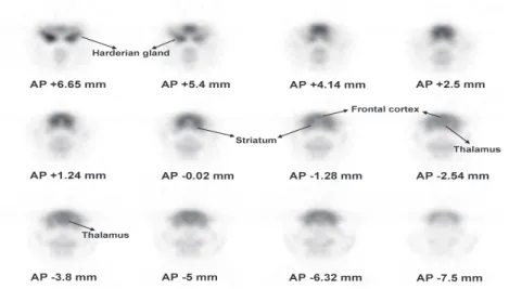 Fig. 2. MicroPET images of coronal sections through the rat brain. Images are arranged in order from rostral to caudal and the AP coordinates position the  microPET images using the bregma as a reference point