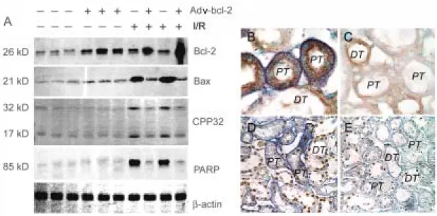 Figure 5. Effect of Adv-bcl-2 gene transfer on O 2 -.