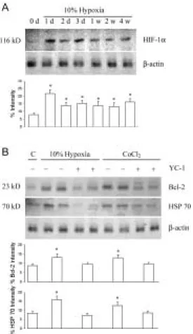 Fig. 1 Hypoxia effect on HIF-1α, Bcl-2, and HSP 70 protein expression. A. 10% 