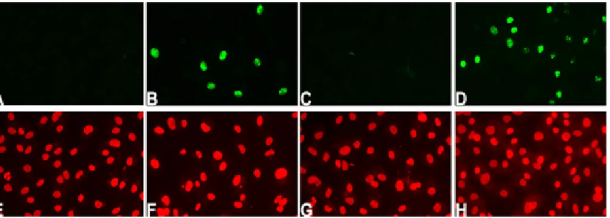 Figure 3. Immunolocalization of Ki67 in confluent cultures of rat corneal endothelial  cells incubated minus FBS (A, E); in 50 µM SOV alone (B, F); in 5 mM EGTA alone  (C, G); or in 5 mM EGTA plus 10% FBS (D, H)