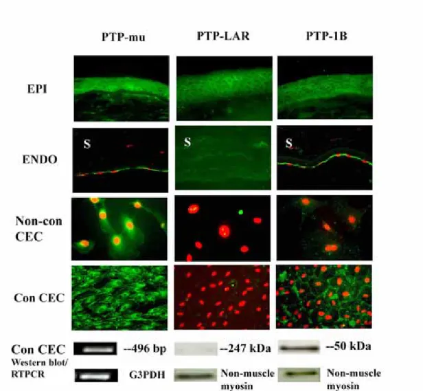 Figure 4. Immunolocalization of PTP-mu, PTP-LAR, and PTP1B in rat corneal cells. 