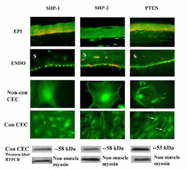Figure 5. Expression of SHP-1, SHP-2, and PTEN in rat corneal cells. ICC studies  confirm the expression of SHP-1, SHP-2 and PTEN (green) in corneal epithelium,  corneal endothelium, confluent and non-confluent rat corneal endothelial cells