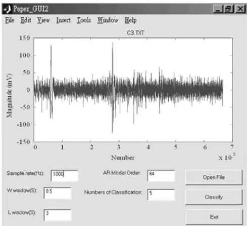 Fig. 8. The result of classification for EEG signals (C3).