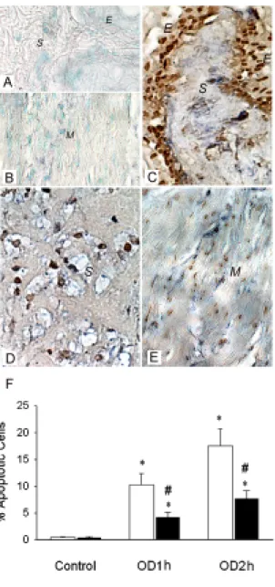 Figure 3. In situ localization of ROS activity and apoptotic cells in OD/E bladder. 