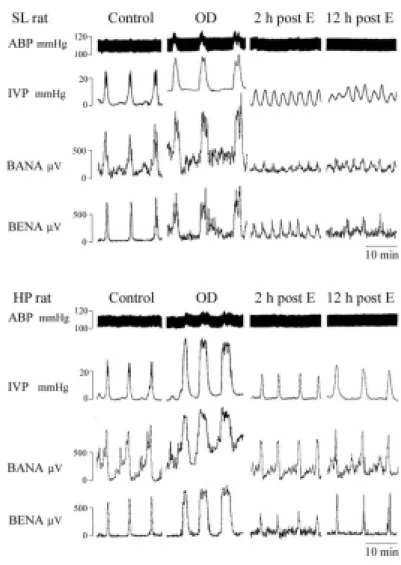 Figure 7. OD/E injury impairs voiding function. During the control stage, the  bladders were filled with 0.9% saline (0.1 ml/min) and allowed to void spontaneously