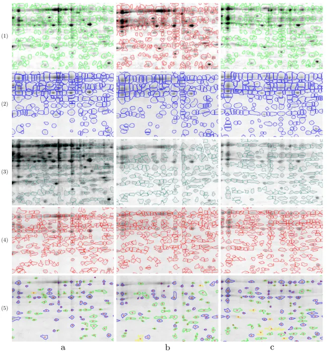 Fig. 10. Comparison of spot detection. Rows for (1) Delta2D, (2) Progenesis, (3) Proteomweaver, (4) ImageMaster 2D Platinum and (5) Our method