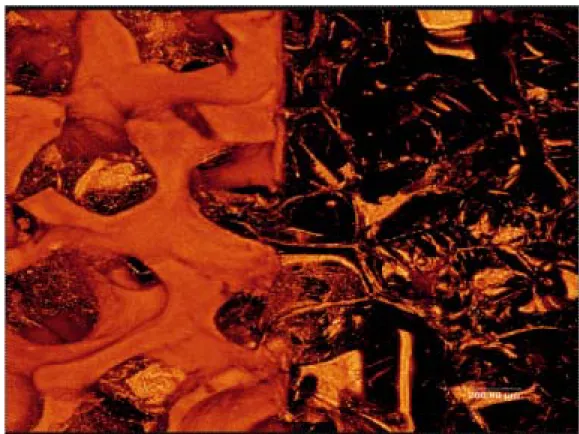 Fig. 5 Under confocal microscope examination, porous gelatin structure can be seen,  and the gelatin structure had infiltrated into the pores of calcium phosphate