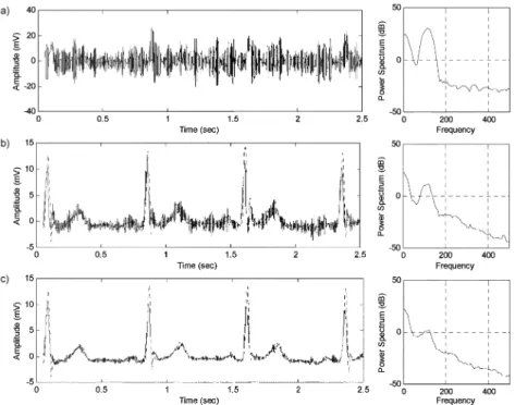 Fig. 4. (a) Noisy simulated trial with SNR of 010 dB. (b) Result obtained by RBF-NLMS