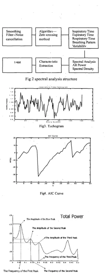 Fig  1.  The Ventrako  recorded flow waveform 