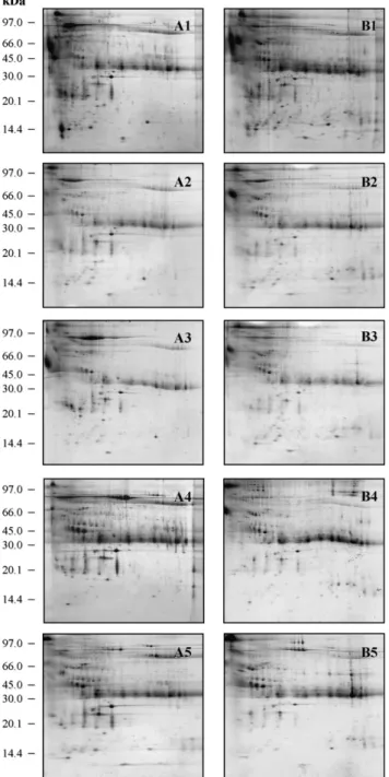 Fig. 5. 2DE patterns of pooled urine samples from normal (A) and lung cancer (B) by using different techniques of sample preparation