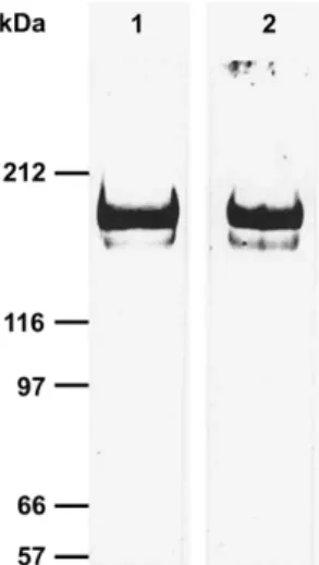 Fig. 1. Homogeneity of the purified CP of P. monodon. (1) SDS-PAGE (on a 5% gel); (2) Western blot.