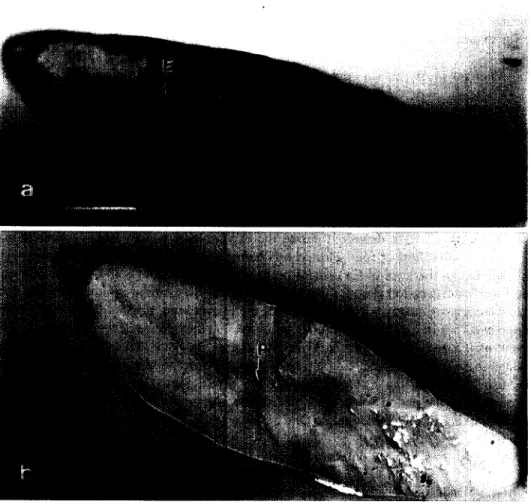 Fig.  1.  Microphotographs  of  the  otolith  from  a  162  mm  TL  eel  showing  (a,  c):  primordium  (P);  leptocephalus  metamorphosis  check  (M);  elver  check  (E)  and  (b)  17  microprobe  spots
