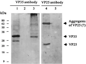 FIG. 6. Temporal transcription analysis of WSSV by RT-PCR. (A) RT-PCR with vp35-specific primers