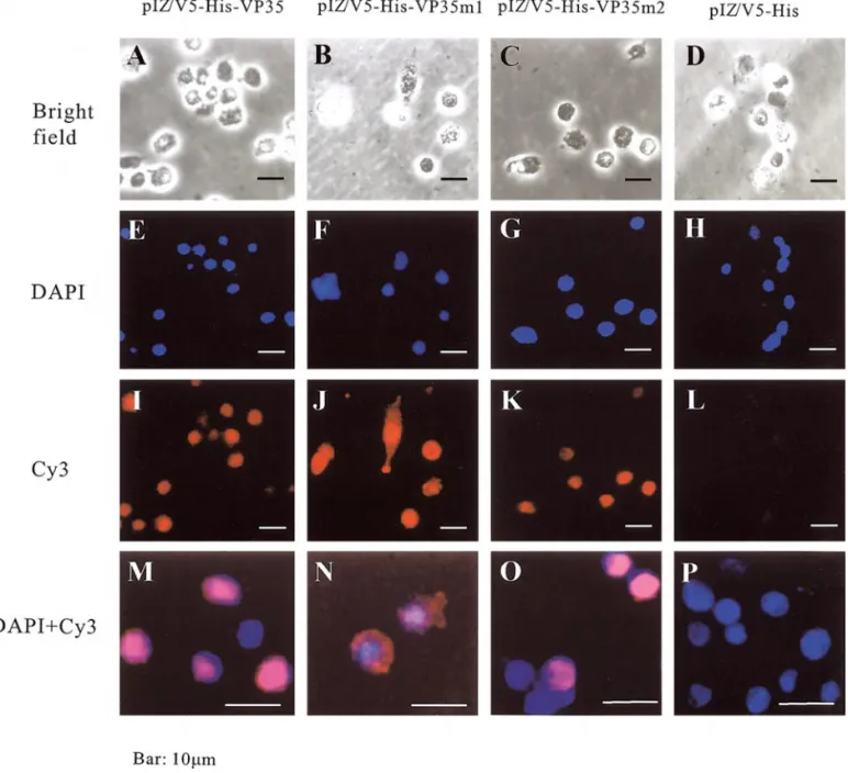 FIG. 9. Intracellular localization of normal VP35 and two NLS-mutant VP35 proteins in Sf9 cells